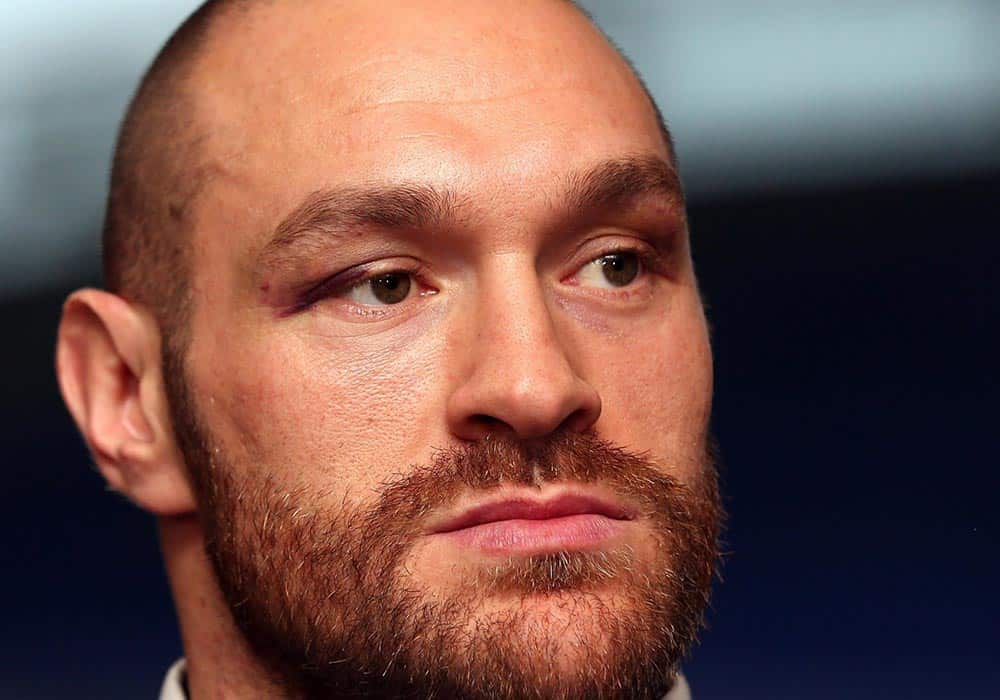 Tyson Fury – slučajni svjetski šampion