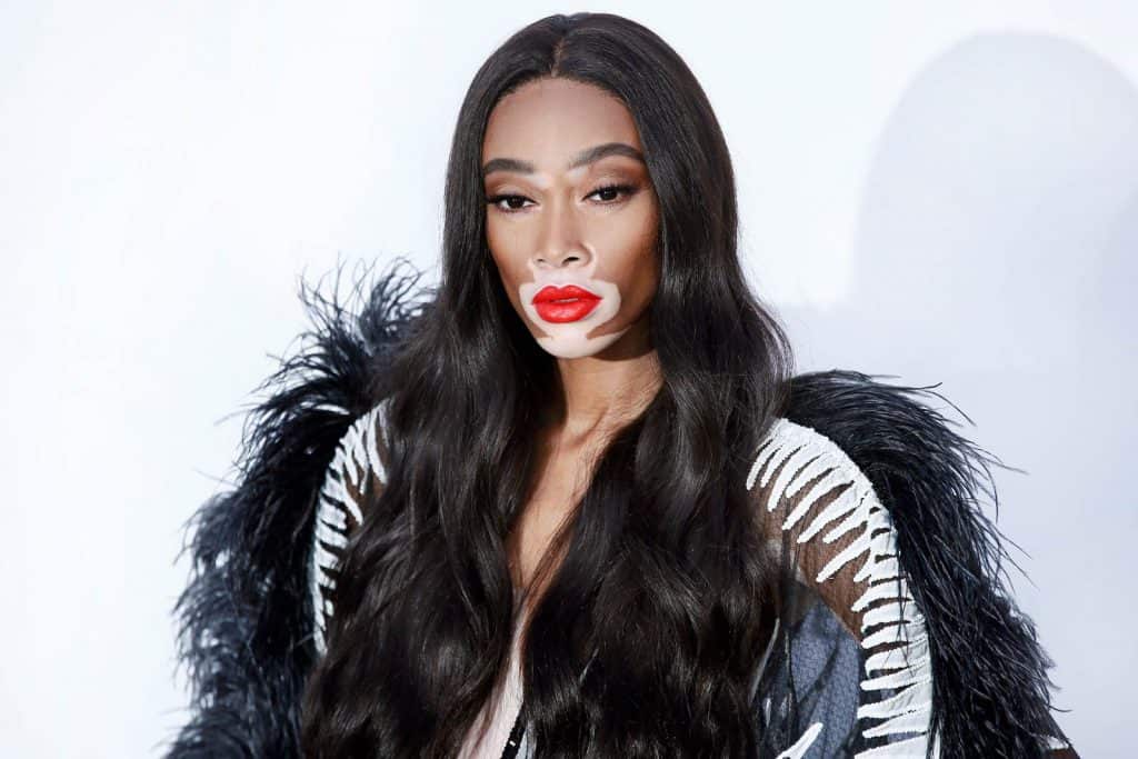 Winnie Harlow
